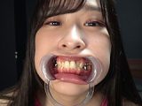 【歯＆口腔】人気女優 朝比ゆのチャンの歯＆口腔＆のどちんこ観察と小魚舐め！