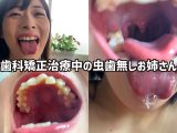 街角で声をかけて口内観察させてもらう ファーストフード店パート みおりさん